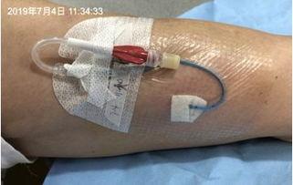 成人包茎清理方法视频大全,轻松掌握健康清洁技巧